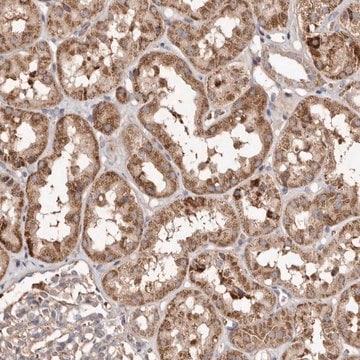 Anti-MACC1 antibody produced in rabbit Prestige Antibodies&#174; Powered by Atlas Antibodies, affinity isolated antibody, buffered aqueous glycerol solution