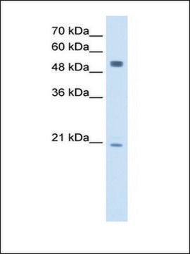 Anti-BLK antibody produced in rabbit IgG fraction of antiserum