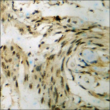 Anti-phospho-p70 S6 Kinase (pSer424) antibody produced in rabbit affinity isolated antibody