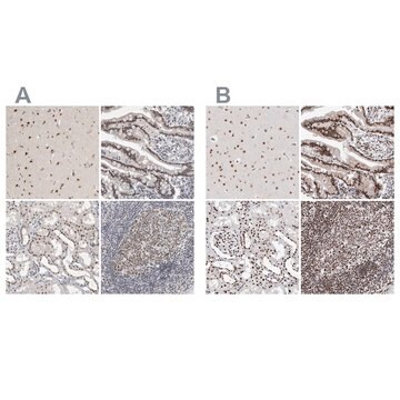 Anti-RBM6 antibody produced in rabbit Prestige Antibodies&#174; Powered by Atlas Antibodies, affinity isolated antibody, buffered aqueous glycerol solution, Ab1