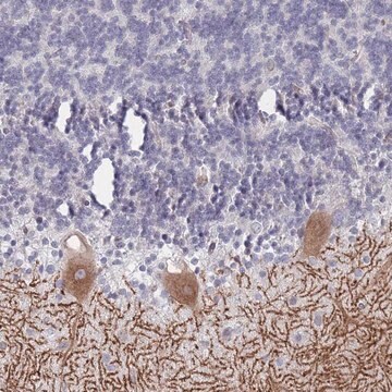 Anti-SLC1A6 antibody produced in rabbit Prestige Antibodies&#174; Powered by Atlas Antibodies, affinity isolated antibody, buffered aqueous glycerol solution