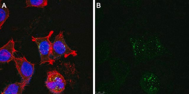 Anti-Golgi Zone Antibody, clone 371-4