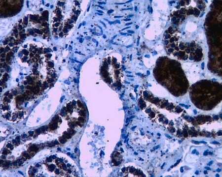 Anti-WNK4 Antibody from rabbit, purified by affinity chromatography