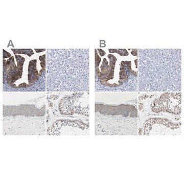 Anti-CCDC6 antibody produced in rabbit Prestige Antibodies&#174; Powered by Atlas Antibodies, affinity isolated antibody, buffered aqueous glycerol solution, Ab1