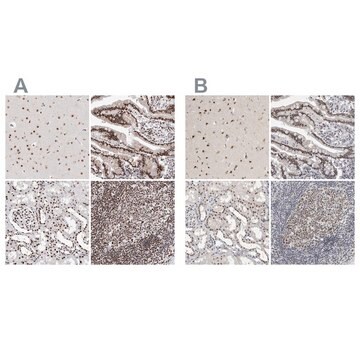 Anti-RBM6 antibody produced in rabbit Prestige Antibodies&#174; Powered by Atlas Antibodies, affinity isolated antibody, buffered aqueous glycerol solution, Ab2