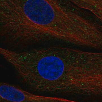 Anti-Appl2 Antibody Produced In Rabbit Prestige Antibodies&#174; Powered by Atlas Antibodies, affinity isolated antibody, buffered aqueous glycerol solution