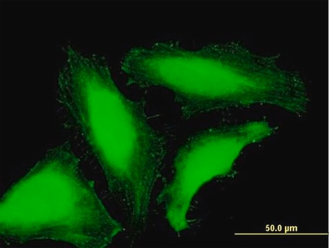 Anti-TBN antibody produced in mouse purified immunoglobulin, buffered aqueous solution