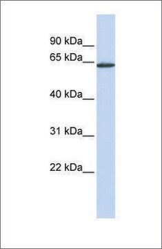 Anti-ANTXR1 antibody produced in rabbit affinity isolated antibody