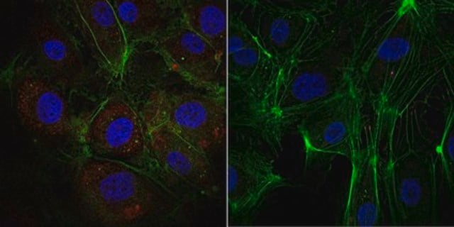 Anti-phospho-VE-Cadherin (Tyr685) Antibody, Alexa Fluor&#8482; 555 Conjugate from rabbit, ALEXA FLUOR&#8482; 555