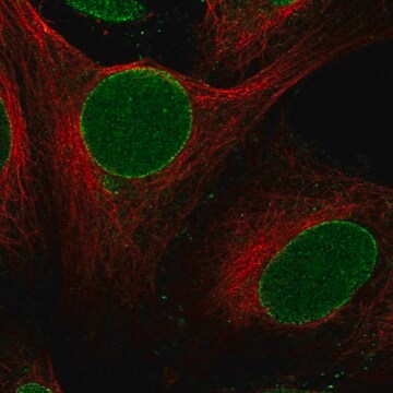 Anti-Znf20 Antibody Produced In Rabbit Prestige Antibodies&#174; Powered by Atlas Antibodies, affinity isolated antibody, buffered aqueous glycerol solution