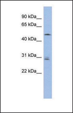 Anti-SMAP1 antibody produced in rabbit affinity isolated antibody