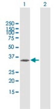 Anti-CENPT antibody produced in mouse purified immunoglobulin, buffered aqueous solution