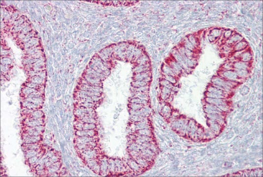 Anti-PDGFB antibody produced in rabbit affinity isolated antibody