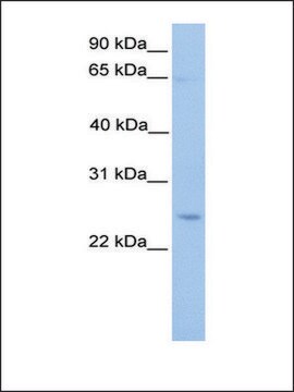 Anti-ATG10 antibody produced in rabbit affinity isolated antibody