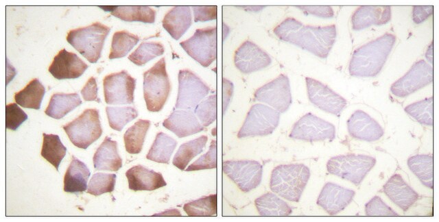 Anti-Tnni3, N-Terminal antibody produced in rabbit affinity isolated antibody