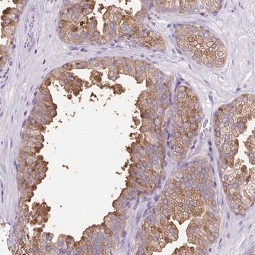 Anti-FAM177B antibody produced in rabbit Prestige Antibodies&#174; Powered by Atlas Antibodies, affinity isolated antibody, buffered aqueous glycerol solution