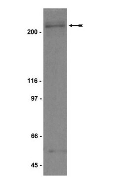 Anticorpo anti-BRCA1 serum, Upstate&#174;