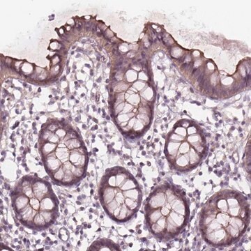 Anti-TCHP antibody produced in rabbit Prestige Antibodies&#174; Powered by Atlas Antibodies, affinity isolated antibody, buffered aqueous glycerol solution