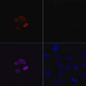 Anti-Acetyl-Histone H4-K16 antibody produced in rabbit