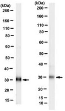 Anti-Tropomyosin 3 Antibody, clone 2G10.2