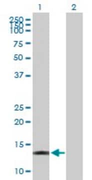 Anti-ACOT13 antibody produced in mouse purified immunoglobulin, buffered aqueous solution