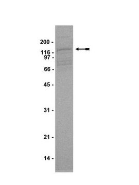 Arg Protein, active, 10 &#181;g Active, N-terminal His6-tagged, recombinant amino acids, 27-end, mouse Arg, for use in Kinase Assays.