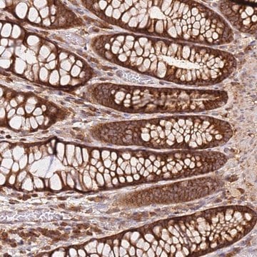 Anti-PIH1D1 antibody produced in rabbit Prestige Antibodies&#174; Powered by Atlas Antibodies, affinity isolated antibody, buffered aqueous glycerol solution