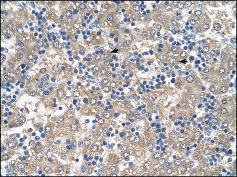 Anti-C3ORF10 antibody produced in rabbit IgG fraction of antiserum