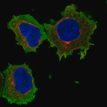 Anti-Arhgap17 Antibody Produced In Rabbit Prestige Antibodies&#174; Powered by Atlas Antibodies, affinity isolated antibody, buffered aqueous glycerol solution