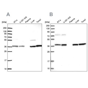 Anti-TALDO1 antibody produced in rabbit Prestige Antibodies&#174; Powered by Atlas Antibodies, affinity isolated antibody