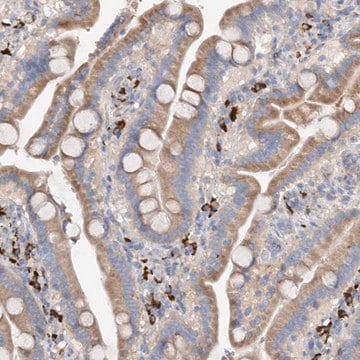 Anti-SLC5A11 antibody produced in rabbit Prestige Antibodies&#174; Powered by Atlas Antibodies, affinity isolated antibody, buffered aqueous glycerol solution