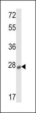 ANTI-SOST (CENTER) antibody produced in rabbit IgG fraction of antiserum, buffered aqueous solution