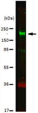 Anti-CDK12 Antibody from rabbit, purified by affinity chromatography