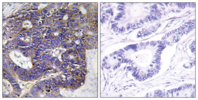 Anti-Collagen IV &#945;2 antibody produced in rabbit affinity isolated antibody