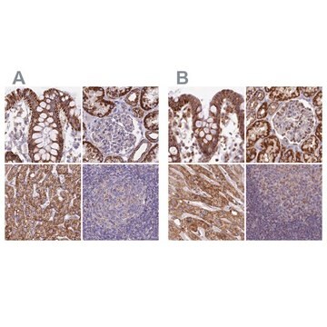 Anti-HSDL2 antibody produced in rabbit Prestige Antibodies&#174; Powered by Atlas Antibodies, affinity isolated antibody, buffered aqueous glycerol solution