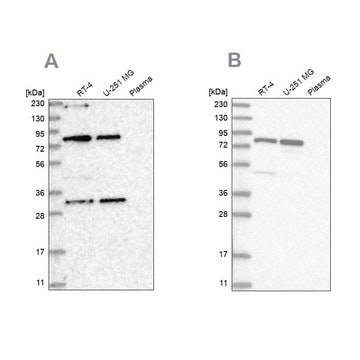 Anti-NOA1 antibody produced in rabbit Prestige Antibodies&#174; Powered by Atlas Antibodies, affinity isolated antibody, buffered aqueous glycerol solution