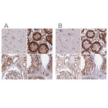 Anti-POLR2C antibody produced in rabbit Prestige Antibodies&#174; Powered by Atlas Antibodies, affinity isolated antibody, buffered aqueous glycerol solution