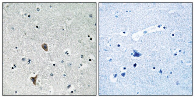 Anti-OXR1 antibody produced in rabbit affinity isolated antibody