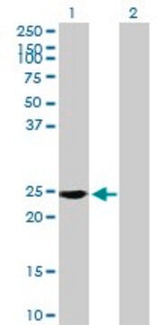 Anti-RAB39 antibody produced in mouse purified immunoglobulin, buffered aqueous solution