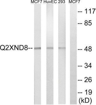 Anti-Cytochrome P450 2D6 antibody produced in rabbit affinity isolated antibody