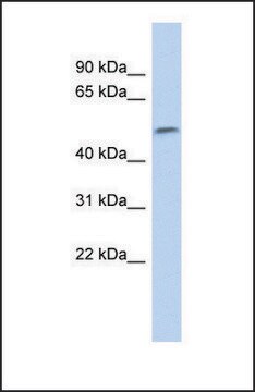 Anti-SOX11 antibody produced in rabbit affinity isolated antibody