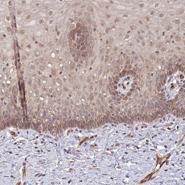 Anti-FUT10 antibody produced in rabbit Prestige Antibodies&#174; Powered by Atlas Antibodies, affinity isolated antibody, buffered aqueous glycerol solution