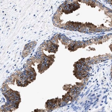 Anti-UBR4 antibody produced in rabbit Prestige Antibodies&#174; Powered by Atlas Antibodies, affinity isolated antibody, buffered aqueous glycerol solution