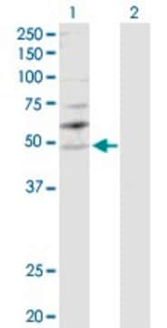 Anti-YBX2 antibody produced in rabbit purified immunoglobulin, buffered aqueous solution