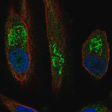 Anti-SLC17A1 antibody produced in rabbit Prestige Antibodies&#174; Powered by Atlas Antibodies, affinity isolated antibody