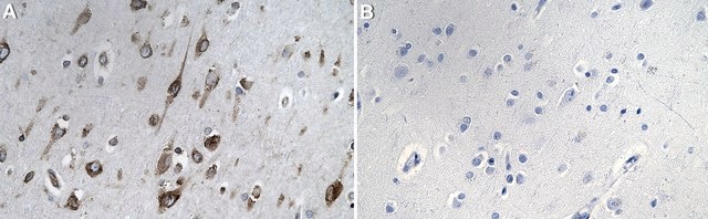 Anti-PDH kinase 1 Antibody, clone 1C7-H1 ZooMAb&#174; Rabbit Monoclonal recombinant, expressed in HEK 293 cells