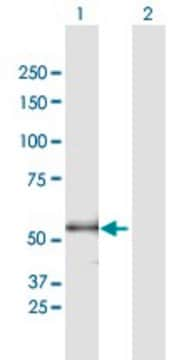 Anti-ENTPD3 antibody produced in mouse purified immunoglobulin, buffered aqueous solution