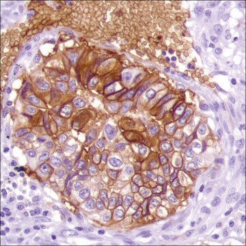 Anti-GLUT-1 antibody, Rabbit monoclonal clone SP168, recombinant, expressed in proprietary host, affinity isolated antibody