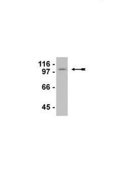 Anticuerpo anti-LSD1/BHC110 ascites fluid, Upstate&#174;