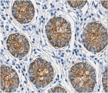 Anti-CEP Antibody, clone Das-1 (7E12H12) clone 7E12H12, from mouse